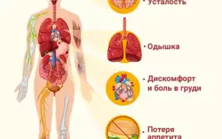 Хроническая сердечная недостаточность: симптомы, причины, лечение и профилактика