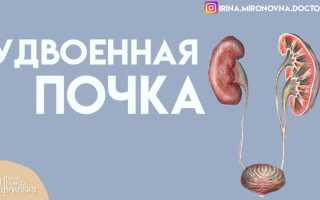 Двойная почка что это такое