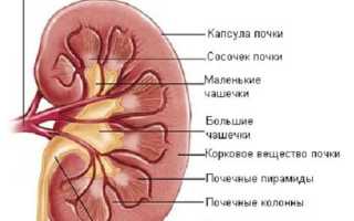 Киста почечного синуса правой почки