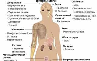 Что такое фибромиалгия? Понимание заболевания и его симптомов