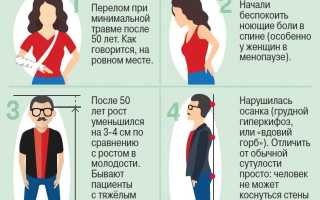7 симптомов остеопороза, которые мы игнорируем, но не должны