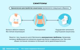 «Медвежья болезнь»: как проявляется, основные принципы лечения и советы специалистов