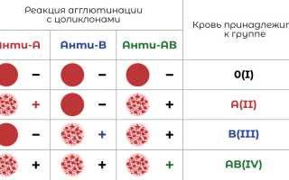 Как определяют группу крови: полезные советы для всех