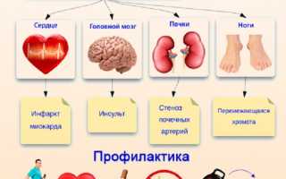 Можно ли предотвратить атеросклероз: советы и рекомендации