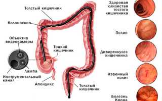 Болезни кишечника и их диагностика: причины и методы