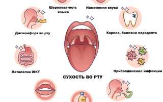 Причины постоянной сухости во рту и их последствия