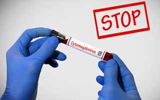 Что такое цитомегаловирусная инфекция? Узнайте больше о заболевании.