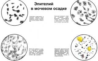 Эпителий плоский в моче единичный